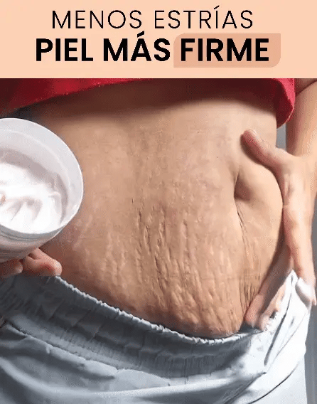 Popozuda- Crema - No más estrias – VIVEBIEN